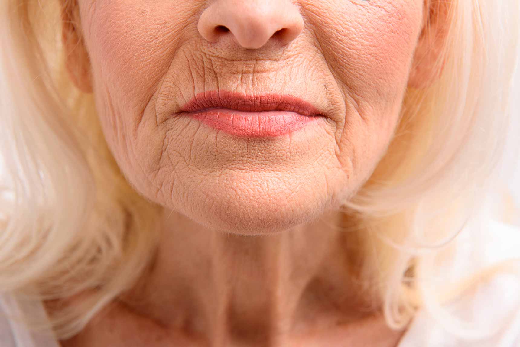 不同年龄段的皮肤衰老表现有哪些呢？该怎样预防皱纹？ - 哔哩哔哩